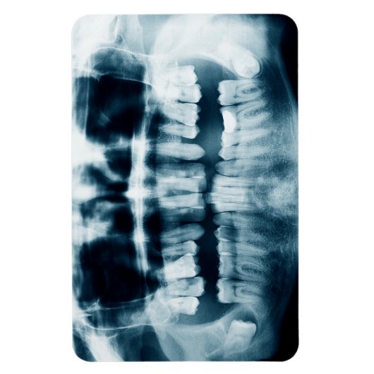 Zähne Röntgenaufnahme Magnet (Vertikal)