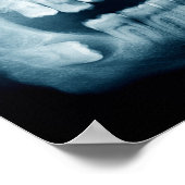 Zähne Röntgenaufnahme Poster (Ecke)