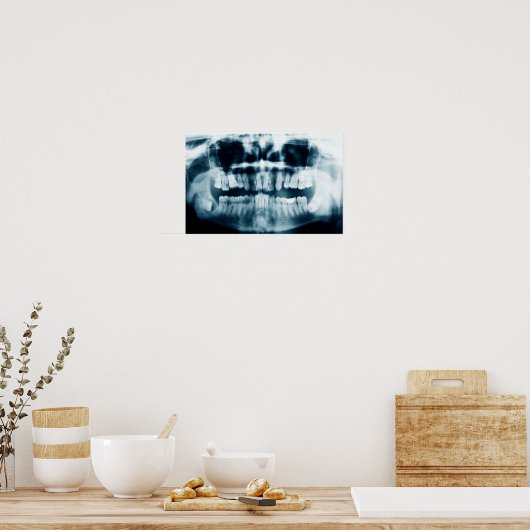 Zähne Röntgenaufnahme Poster (Küche)