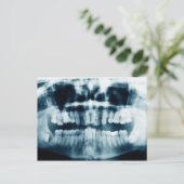 Zähne Röntgenaufnahme Postkarte (Stehend Vorderseite)