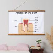 Zahnfleischabszess Wandteppich Mit Holzrahmen (Schlafzimmer)