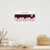 Zahnimplantatprozedur Poster (Küche)