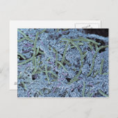 Zahnschild, farbiges Rasterelektronenelement Postkarte (Vorne/Hinten)