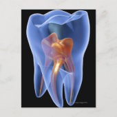 Zahnseide, durchsichtiger Querschnitt eines Molars Postkarte (Vorderseite)