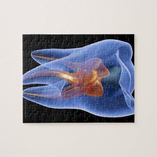 Zahnseide, durchsichtiger Querschnitt eines Molars Puzzle (Horizontal)