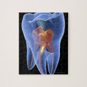 Zahnseide, durchsichtiger Querschnitt eines Molars Puzzle (Vertikal)