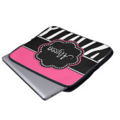 Zebra-Druck-Rosa-Monogrammlaptop Kasten Laptopschutzhülle (Vorne Knopf)