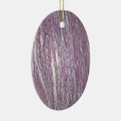 Zellen des menschlichen Gebärmuttergewebes mit Keramikornament (Rechts)