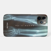 Zerbrochen Radius und Ulna Xray "Break Time" Case-Mate iPhone Hülle (Rückseite (Horizontal))