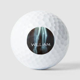 Zerbrochen Radius und Ulna Xray "Break Time" Golfball