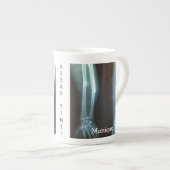 Zerbrochen Radius und Ulna Xray "Break Time" Porzellantasse (Vorderseite Rechts)