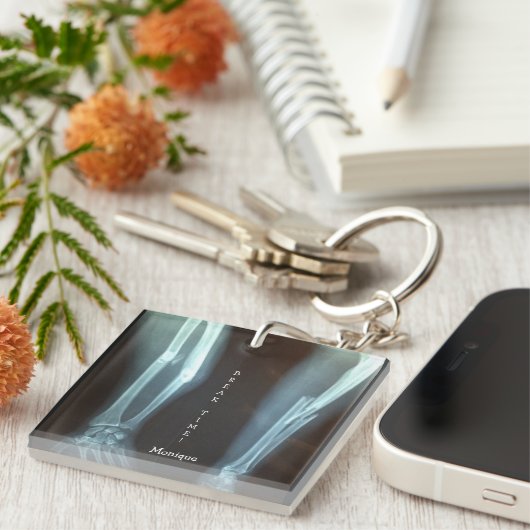 Zerbrochen Radius und Ulna Xray "Break Time" Schlüsselanhänger (Vorderseite rechts)