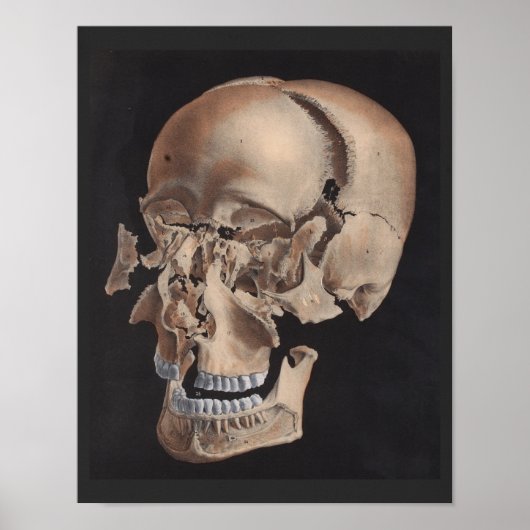 zerstreute Explosionsdrucke Poster (Vorne)