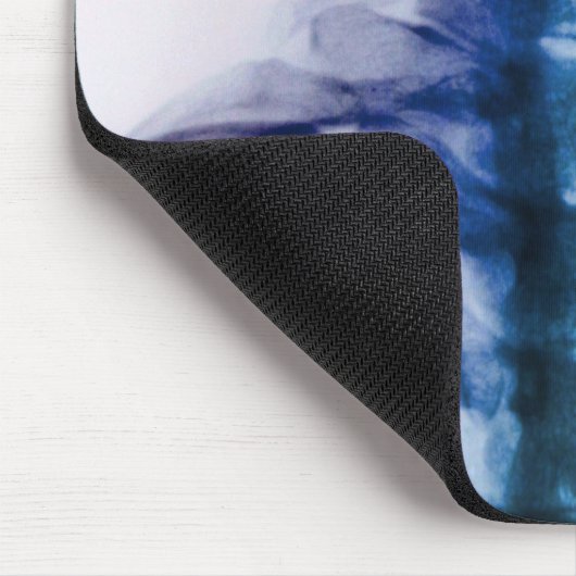 Zervikale Röntgenstrahl-Kunst Digital Mousepad (Ecke)