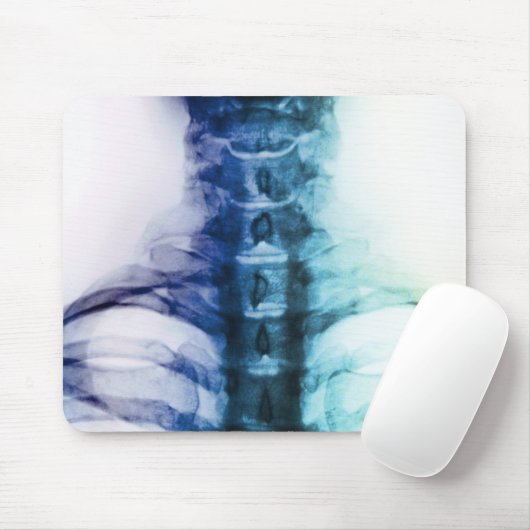 Zervikale Röntgenstrahl-Kunst Digital Mousepad (Mit Mouse)