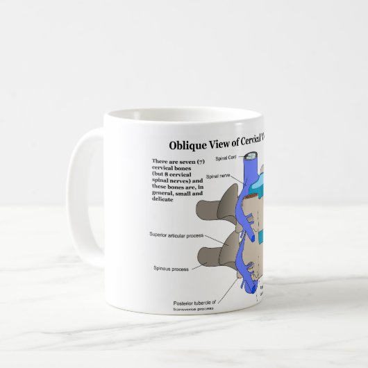 Zervikaler Wirbel der menschlichen Wirbelsäule Kaffeetasse (Vorderseite Links)