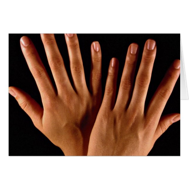 Zwei gekreuzte Hände (Vorderseite (Horizontal))