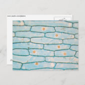 Zwiebel unter dem Mikroskop Postkarte (Vorne/Hinten)