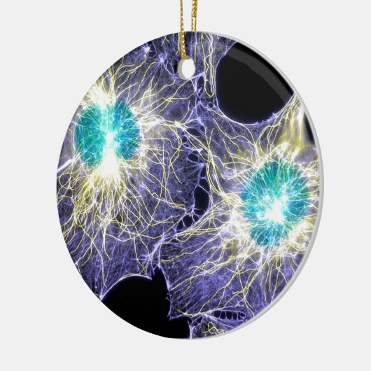 Zwischenphase Keramikornament (Links)